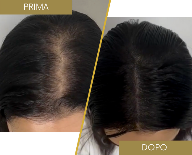 Tricopigmentazione