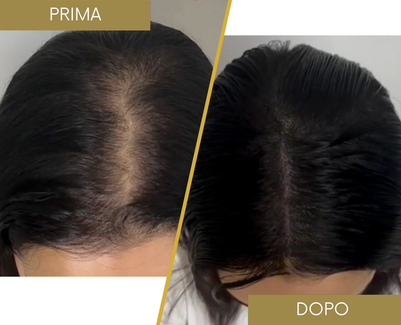 Tricopigmentazione