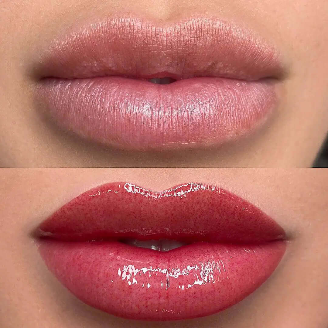 Color Lips - FaceBioma