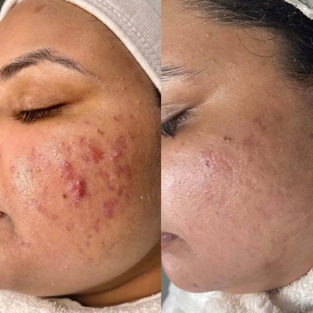 SkinBalance - FaceBioma
