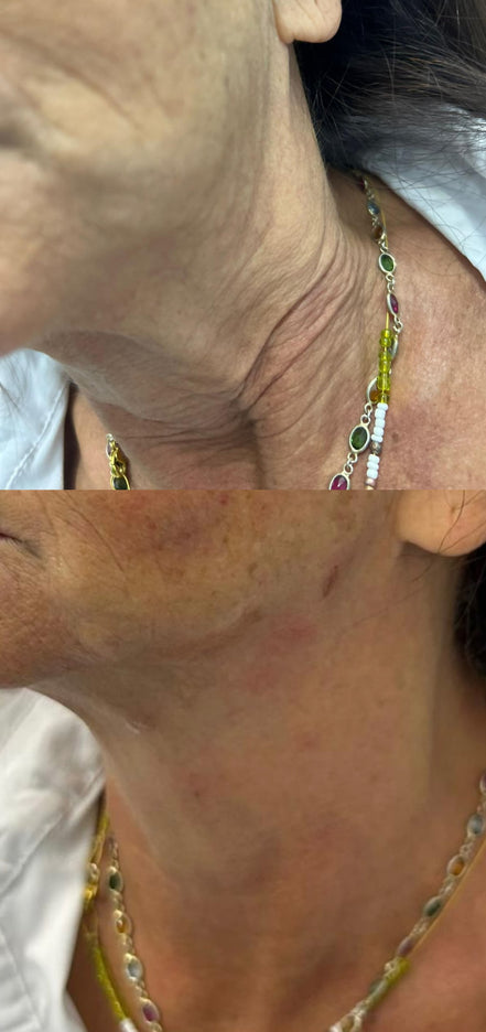 𝑮𝑨𝑩𝑨 𝑳𝒊𝒇𝒕