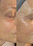 BioLifting - FaceBioma