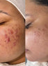 SkinBalance - FaceBioma