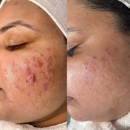 SkinBalance - FaceBioma